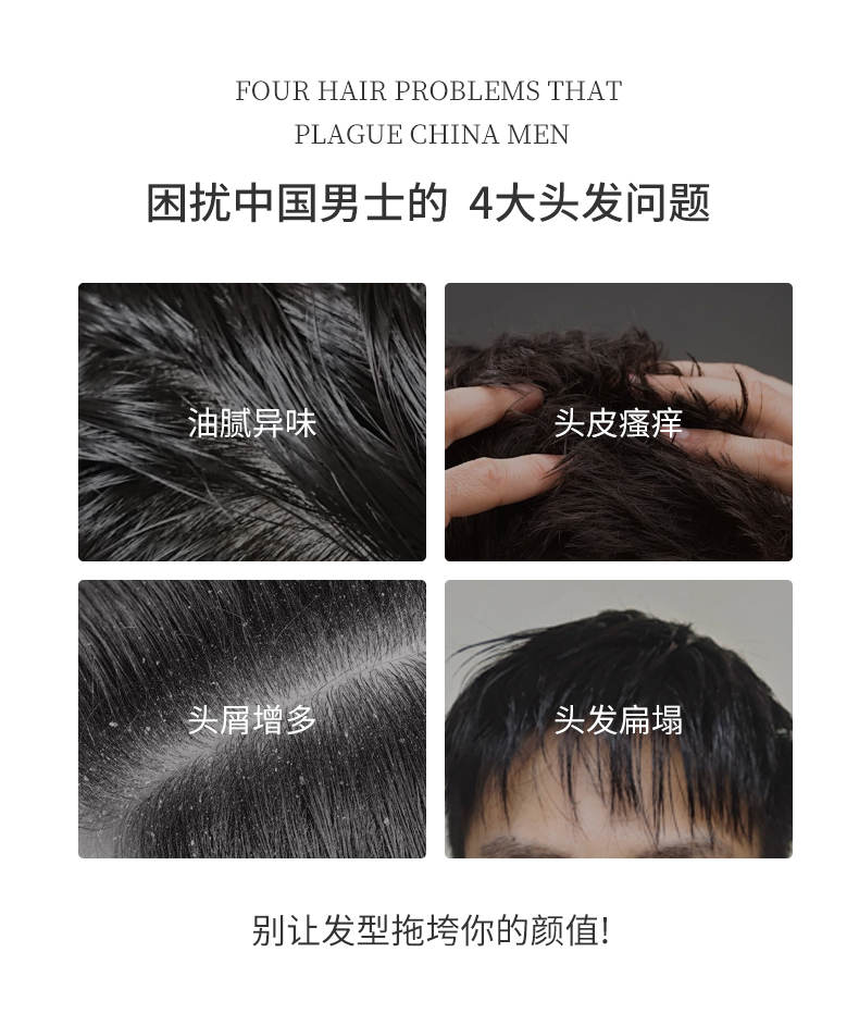 困擾中國(guó)男士的四大問(wèn)題，油膩異味、頭皮瘙癢、頭屑增多、頭發(fā)扁塌